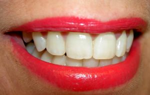 The Mouth as a Lethal Weapon
