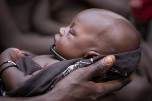 Akou Marial was born under a tree in a South Sudan forest without medical assistance. Akou's mother passed out from blood loss after 2 days of labor.