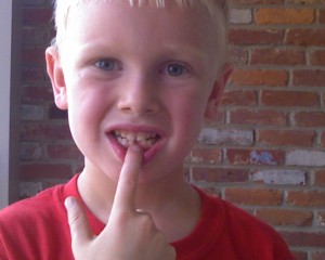Spencer First Loose Tooth