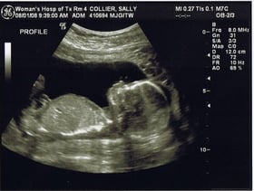 Protecting Life in a neonatal wing