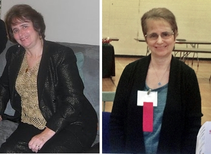 before and after1