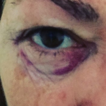 eye